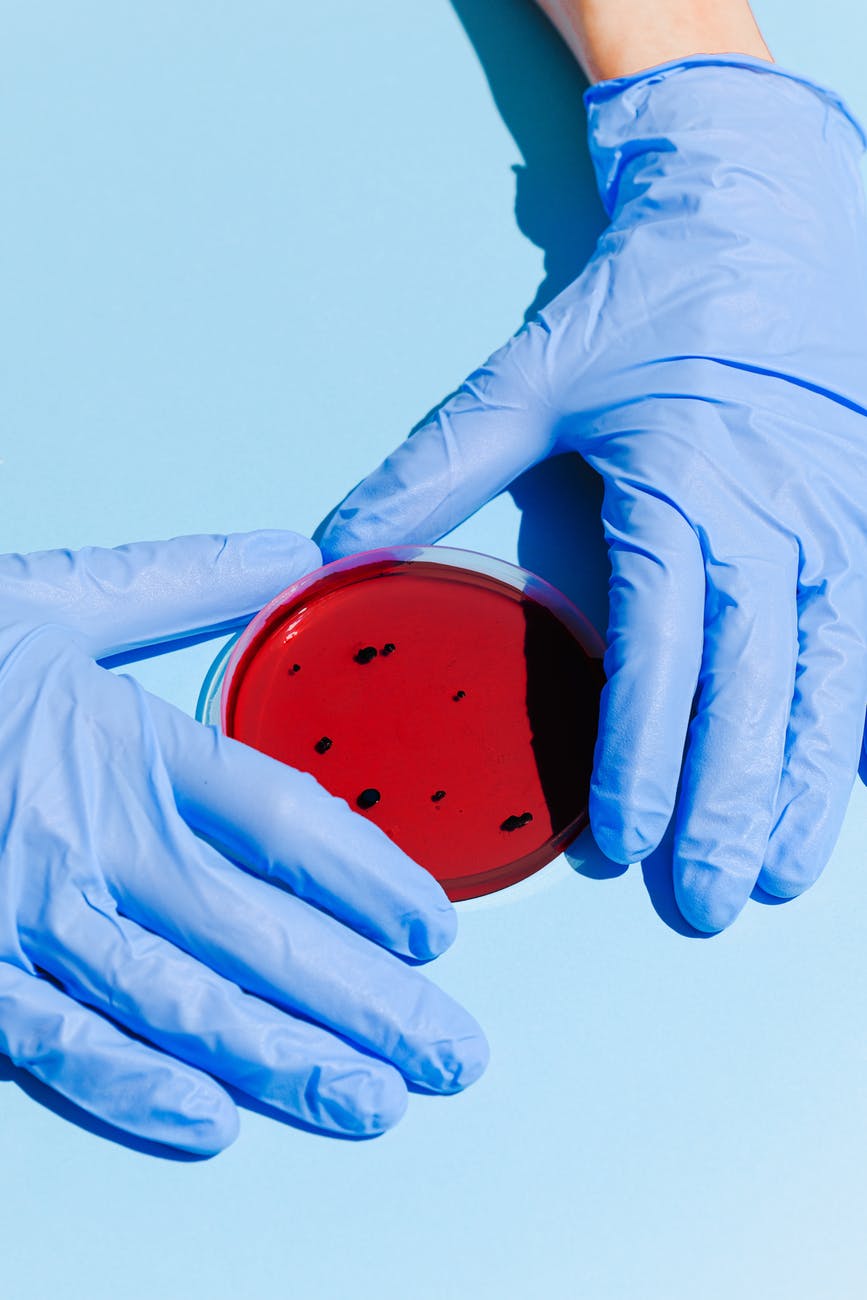 person holding petri dish